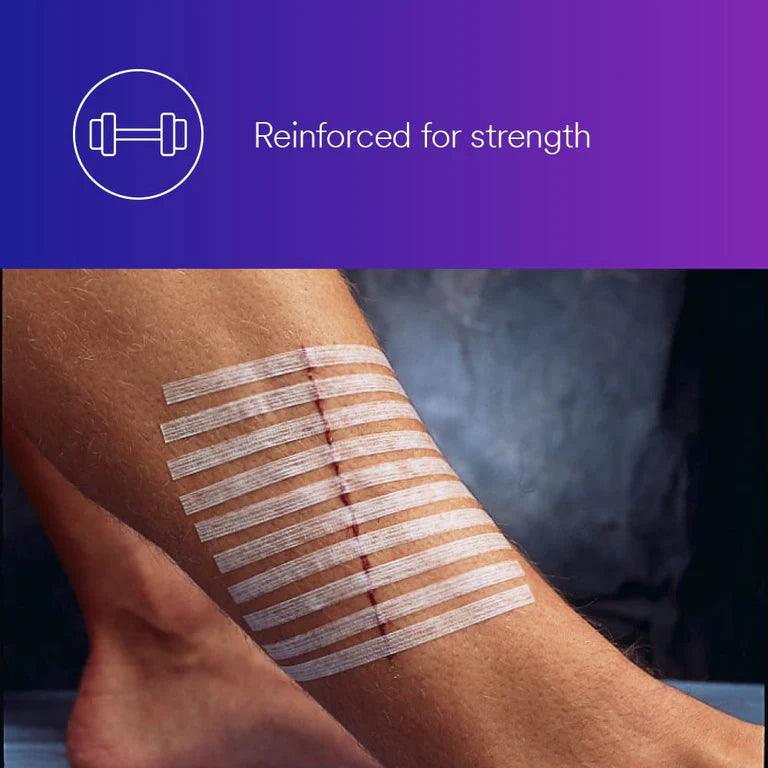Steri-Strips 1/4" x 4" 10 pieces in Pack